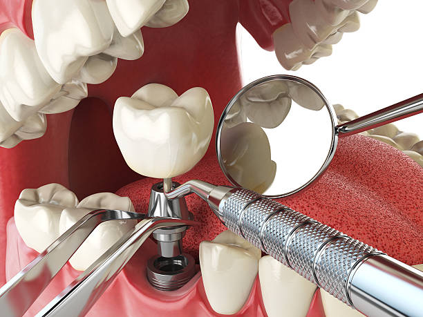 Best Emergency Dental Care for Broken or Chipped Teeth in Pampa, TX